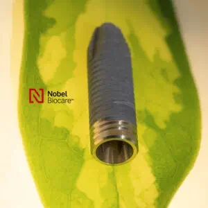 Implant NOBEL