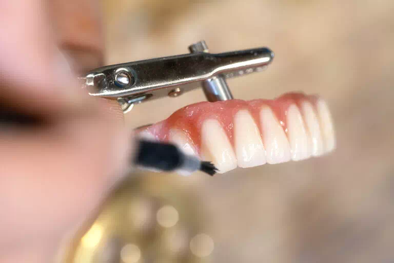 Pose de vernis finalisation prothèse dentaire